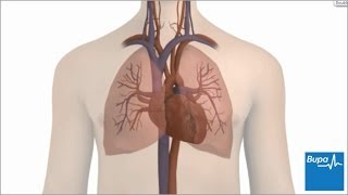 The different types of heart arrhythmia