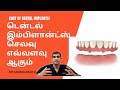      cost of dental implants  dr arunkumar pearls dentistry chennai 