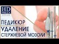 Мастер-класс по удалению стержневой мозоли // HD Freza®