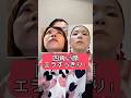 四角いエラを削らずにV字に！#エラ張り #食いしばり