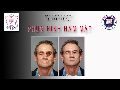 Video PHỤC HÌNH HÀM MẶT - The role of implant in the... - youtube