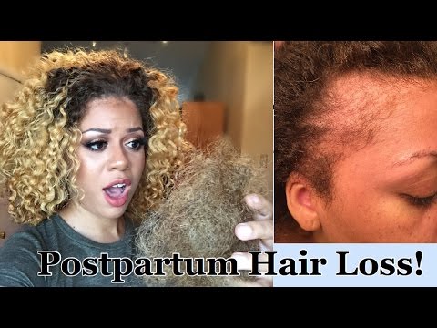 EXTREME HAIR LOSS :-( | Postpartum Shedding and Growing Your Hair Back!