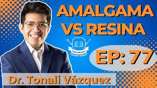 77 AMALGAMAS VS RESINAS | Dr. Tonali Vázquez