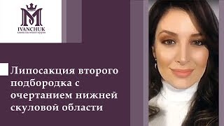 Как победить двойной подбородок? Липосакция в Киеве