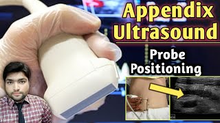 Mastering Appendix Ultrasound | A Step-by-Step Guide to Accurate Probe Positioning
