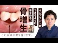 札幌市の歯医者「ユアーズデンタル クリニック」インプラントの骨増生（骨を作る治療）