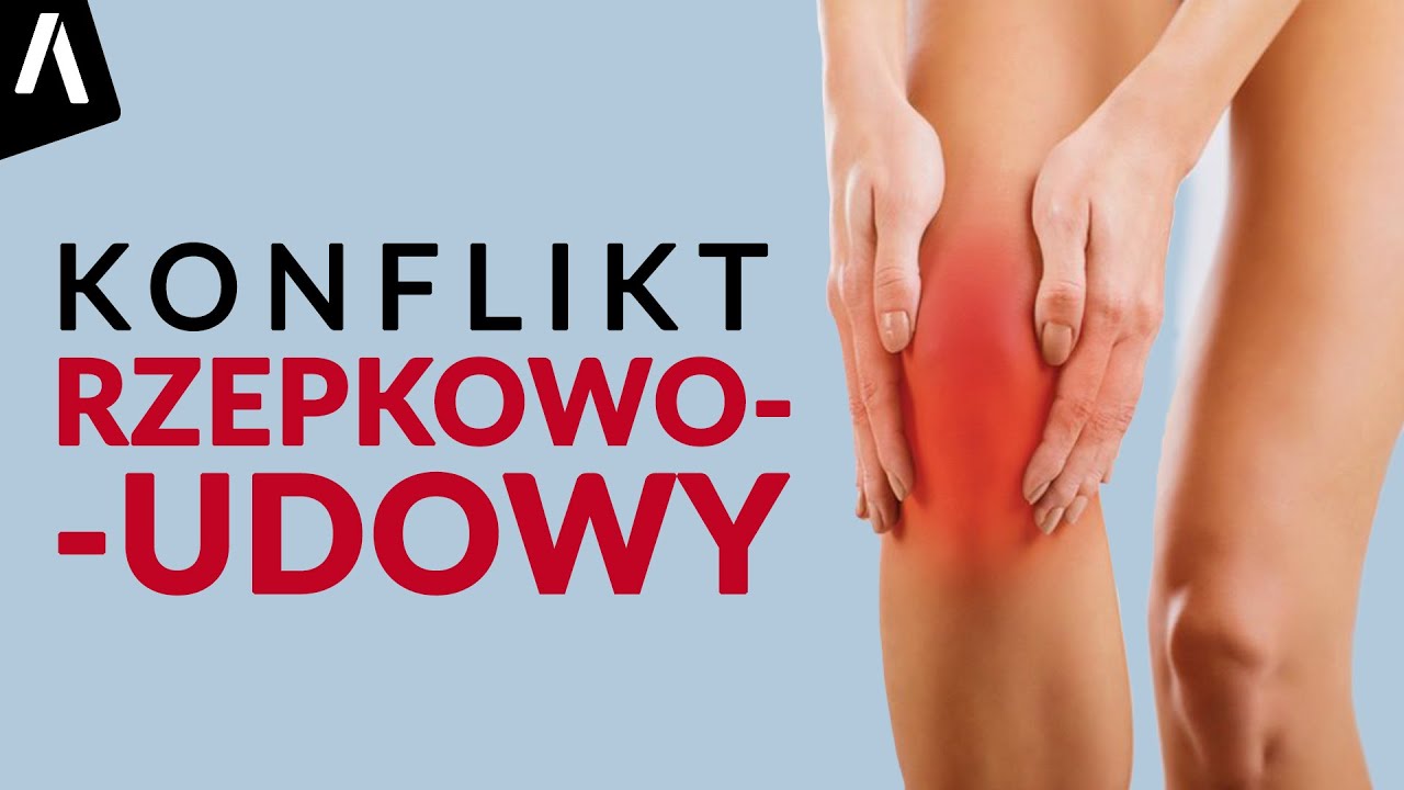 Ból kolana z przodu, czyli konflikt rzepkowo-udowy