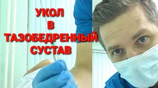 УКОЛ В ТАЗОБЕДРЕННЫЙ СУСТАВ. ГИАЛУРОНОВАЯ КИСЛОТА.