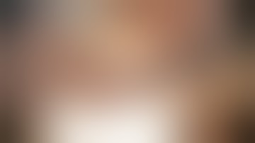 Phẫu thuật nội soi cắt túi mật theo tiêu chuẩn CVS