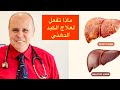 دهون وتشحم الكبد /علاج دهون الكبد بدون ادويه