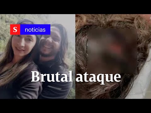 Viva de milagro: la increíble historia de mujer atacada con hacha en la cabeza | Semana Noticias