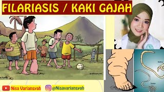 FILARIASIS - Kaki Gajah Menyebabkan Kaki Bengkak Penjelasan Lengkap Cacing Dan Nyamuk