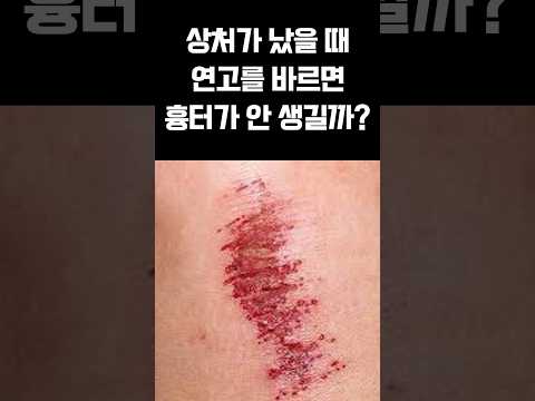상처에 바르는 연고의 <strong>효능</strong> #상처치료 #<strong>흉터치료</strong> #오가나셀피부과