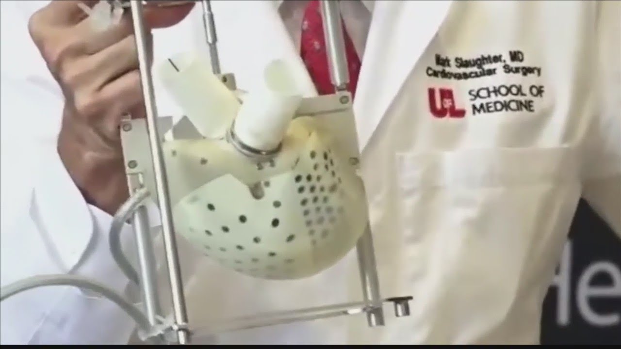 Doctors perform first total artificial heart transplant in woman