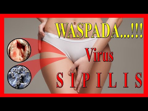 cara-mengobati-virus-sipilis-wanita---obat-sipilis-raja-singa-di-apotik-paling-ampuh
