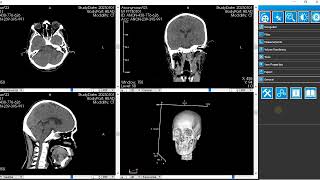 iQ-View or iQ-3D Trial Bypass Tools
