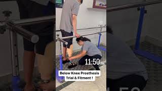 Below Knee Prosthesis Trial & Fitment !