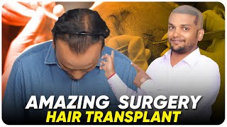Hair Transplant in Surat | Best Results & Cost of Hair Transplant in Surat