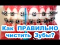 ✅Как Ухаживать за Брекетами?🔴 Как Чистить Зубы с Брекетами? — Советы Ортодонта!