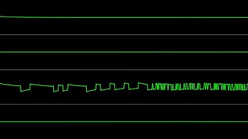 Bartosz Kalinowski (Bartman) - "Shadows Party Invitro" [Atari 8-bit] (Chiptune Visualization)