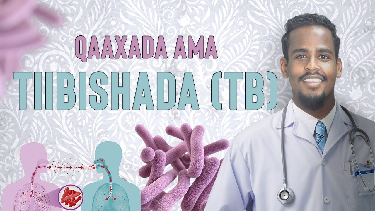QAAXADA AMA TIIBISHADA TUBELCLOSIS