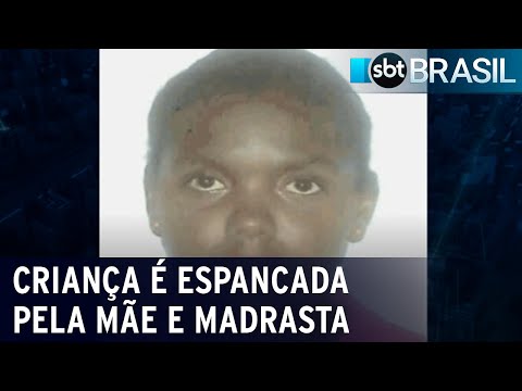 Vídeo: Menina Espancada Até A Morte Com Síndrome De Down