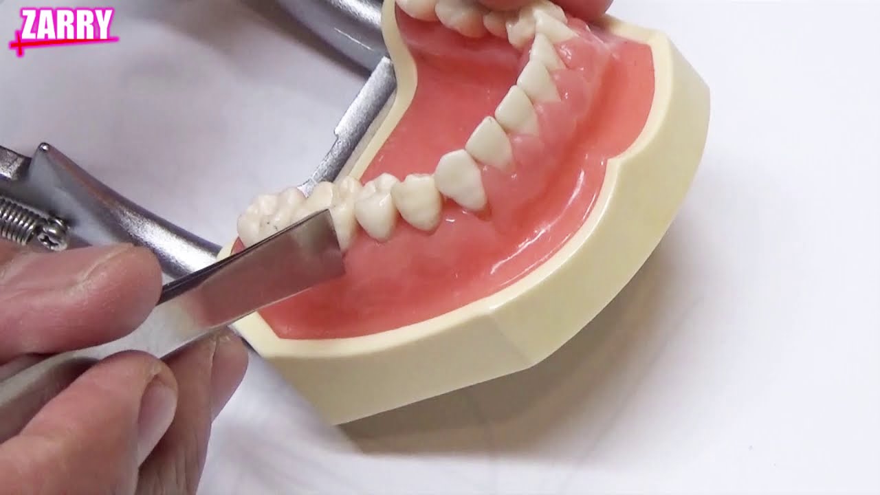 歯 の 打診 痛
