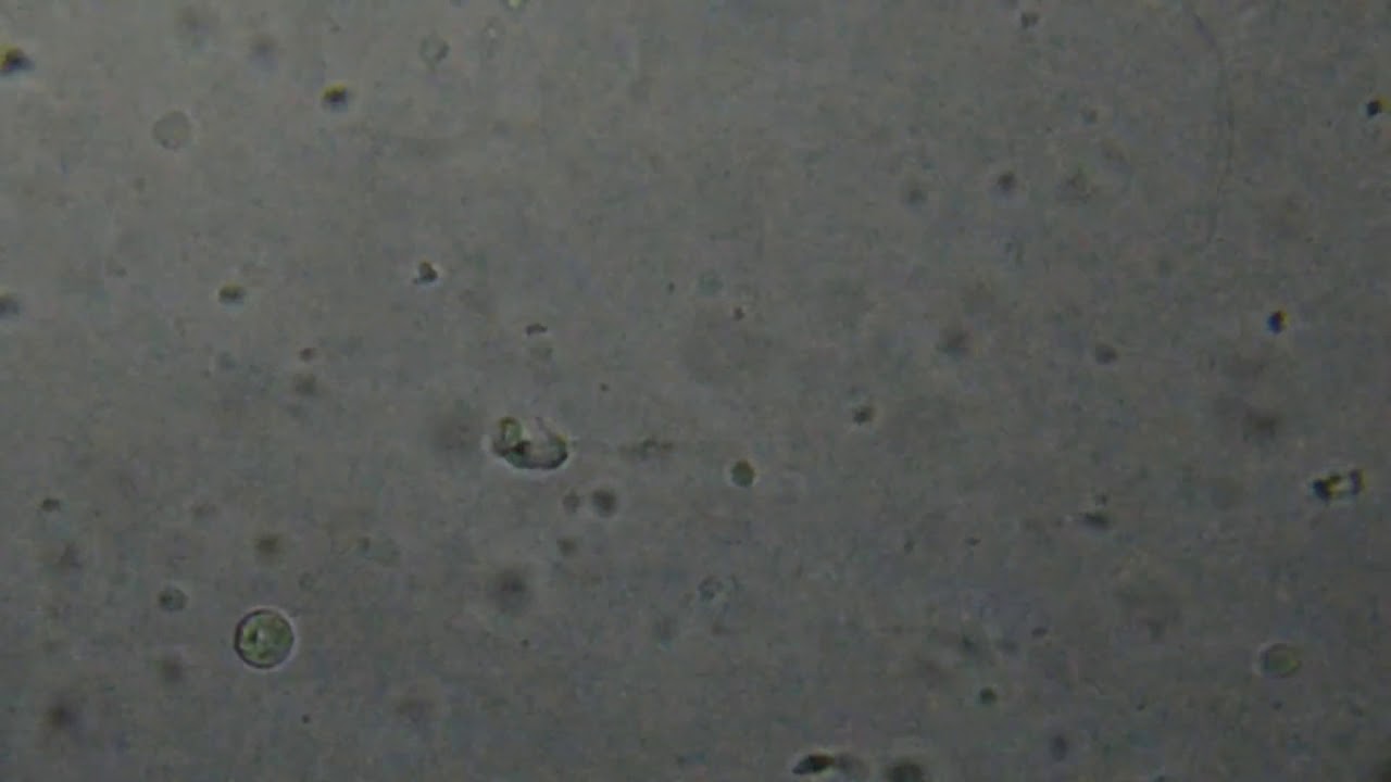 显微镜下的精子1000x 1600x Youtube