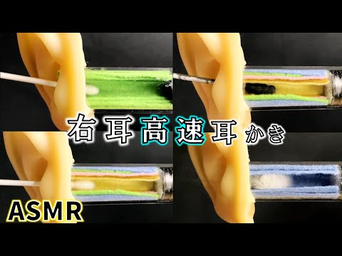 【耳かき 高速耳かき 綿棒 梵天】右の高速耳かき30分！綿棒と梵天で高速耳かきしています♪|High-speed earpick  |高速耳扒| 귀이개 체험【AK ASMR】