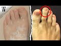 FOOT SHAPE ANCESTRY You Shouldn