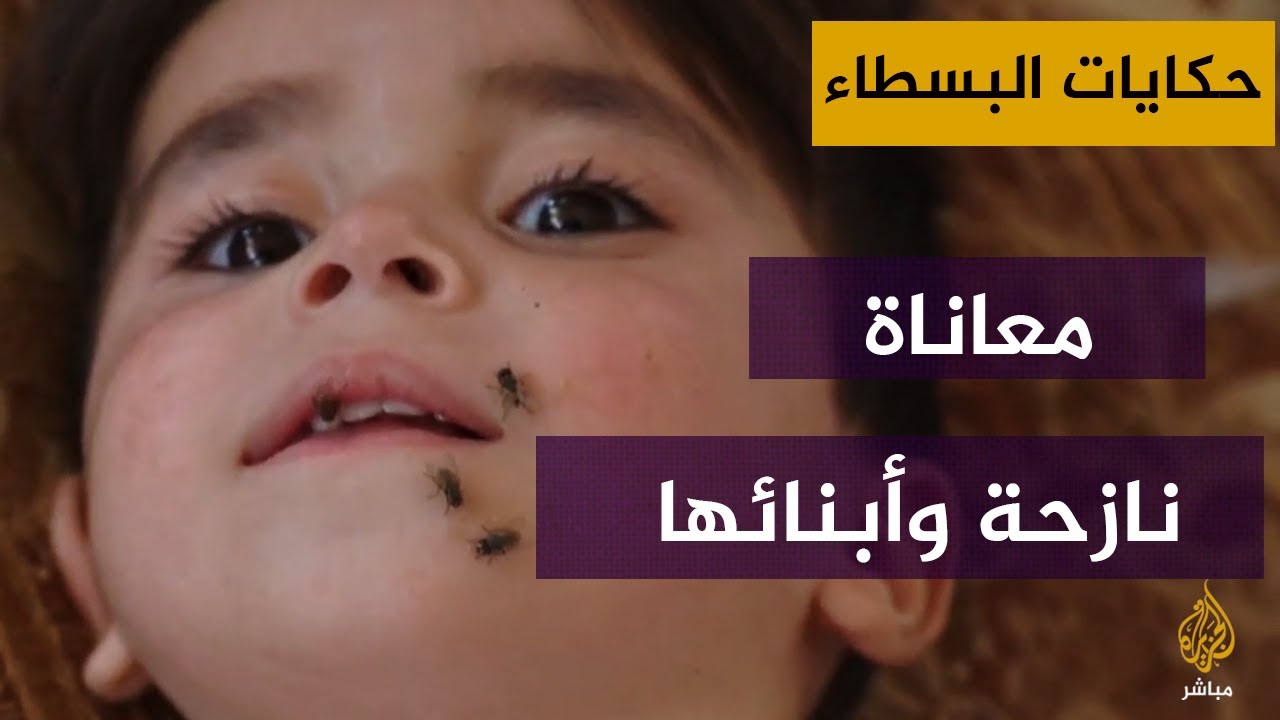 نازحة سورية يعاني أطفالها من ضمور المخ وسوء التغذية