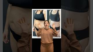 #plasticsurgery #tummytucksurgery #moms #diastasisrecti #tummytuckjourney #cosmeticsurgery