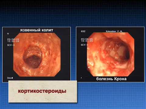 Месалазин - характеристика субстанции, механизм действия при ВЗК