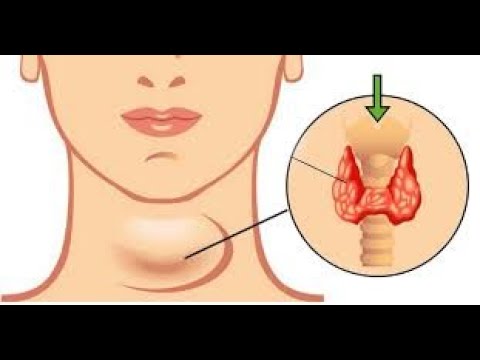 الكالسيتونين أمراض الغدة الدرقية الجويتر البسيط والجحوظى الصف الثالث الثانوى احياء الهرمونات