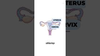 Ovarian Cancer is rare, not impossible