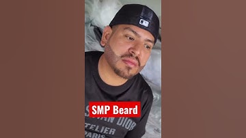 Scalp Micropigmentation Beard Before and After