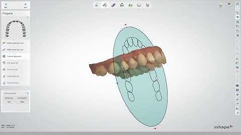 Workflow von Connect Case Center Inbox zu 3Shape: Patientenfall Veneer