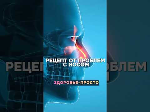 Домашний рецепт, который избавит от проблем с носом #здоровье #рецепт #синусит #лечение