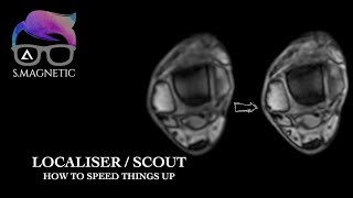 LOCALISER/ SCOUT. HOW TO SPEED THINGS UP