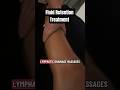 Fluid Retention Treatment Through Lymphatic Drainage Massages #shorts #lymphaticsystem