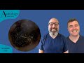 CHOCKABLOCK EAR WAX REMOVAL/WET SKIN REMOVAL - EP758