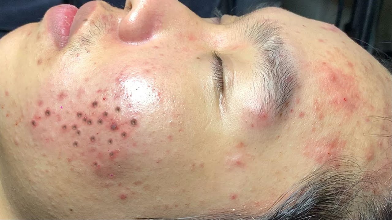 Satisfying Hien Spa Beauty Relaxing Video #09