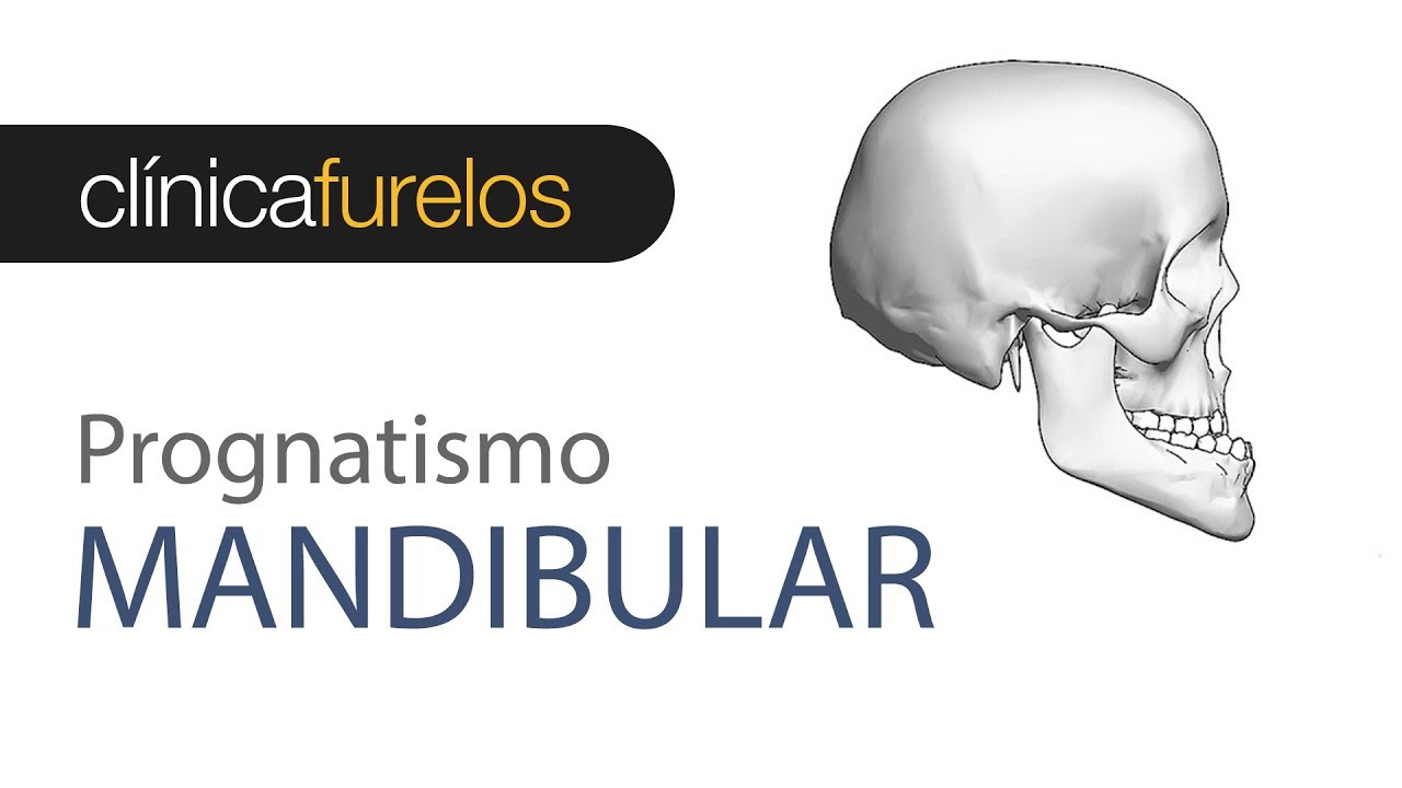 Prognatismo mandibular - Entrevista al Dr. Furelos en Cadena Cope