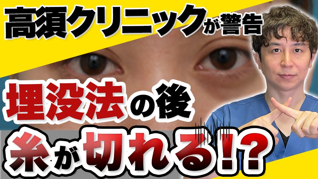 高須クリニック 失敗(02)