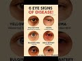 👁️ &ldquo;6 Eye Signs That Reveal Hidden Diseases! 😳 What Your Eyes Say About Your Health!&rdquo; #shorts #food
