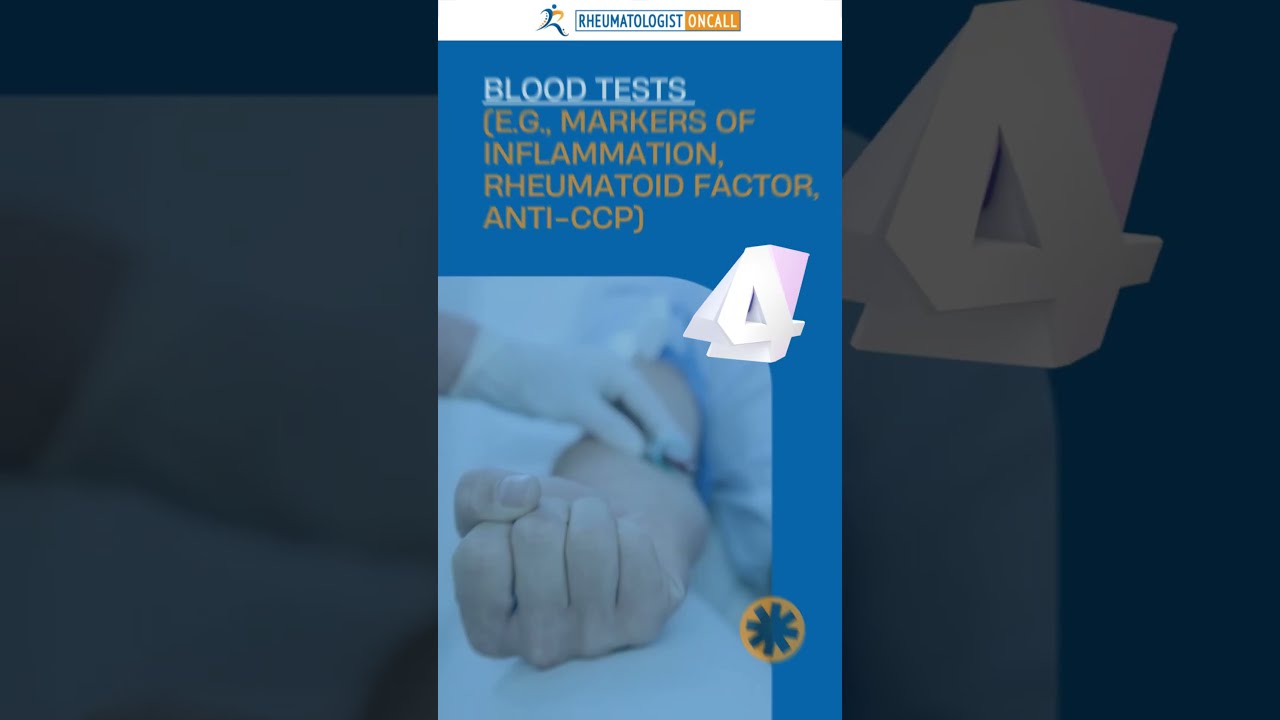 6 Criteria To Diagnose Rheumatoid Arthritis