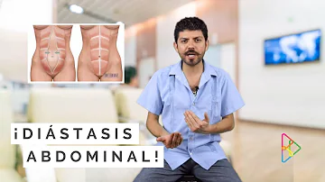 ¿Qué es una fisura abdominal?