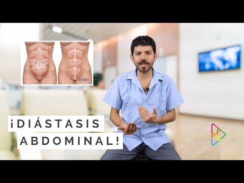 ¿QUÉ ES LA DIÁSTASIS ABDOMINAL? hqdefault