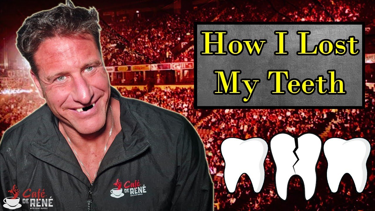 How Rene Dupree LOST his TEETH