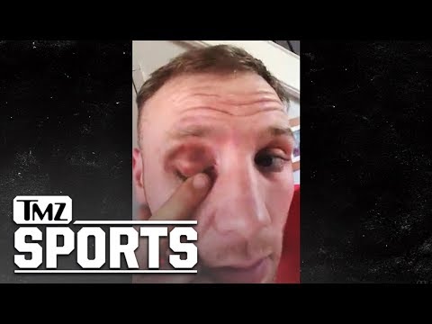 Conor McGregor Hit Me with Brutal, Cheap Shot on Video, Boxer Claims | TMZ Sports